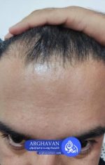 2025-06-07-14.41.03-r6yeumis5s2kvcq2a671525tnfxdmalj2rnzgdse24